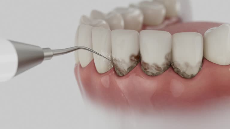 Trusted Teeth Cleaning And Checkup service in Tryon, NC - Dentist Open Now